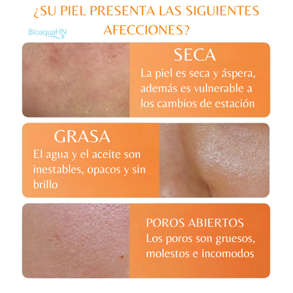 Kit Skincare Vitamina C Antimanchas Aclarante Bioaqua